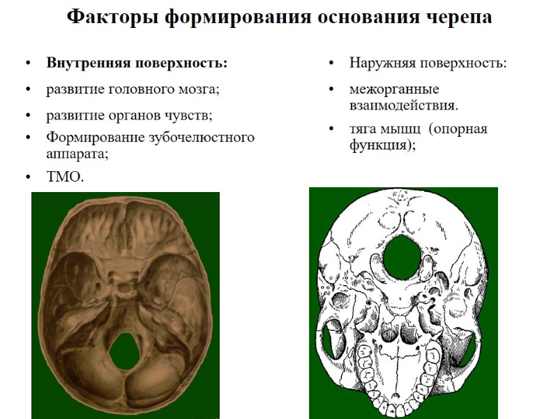 Факторы формирования основания черепа Внутренняя поверхность: развитие головного мозга; развитие органов чувств;  Формирование